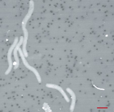 環境中から得られた化学合成微生物の電子顕微鏡写真。赤棒は1µmを示す。(写真提供:吉富泰助氏(東京大学大学院理学系研究科))