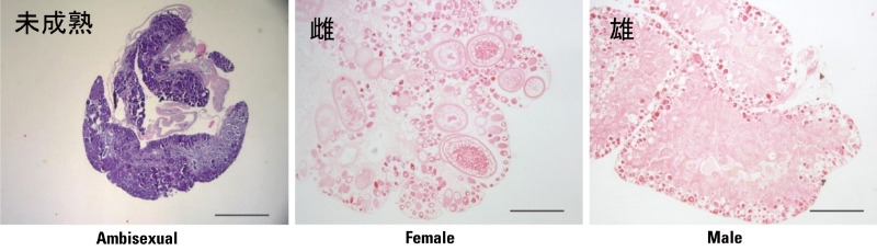 ■Figure 2: Gonadal tissues of the common anemonefish (Scale: 500 μm)